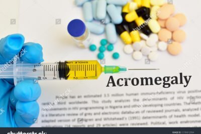 que medicamentos se utilizan para tratar la acromegalia