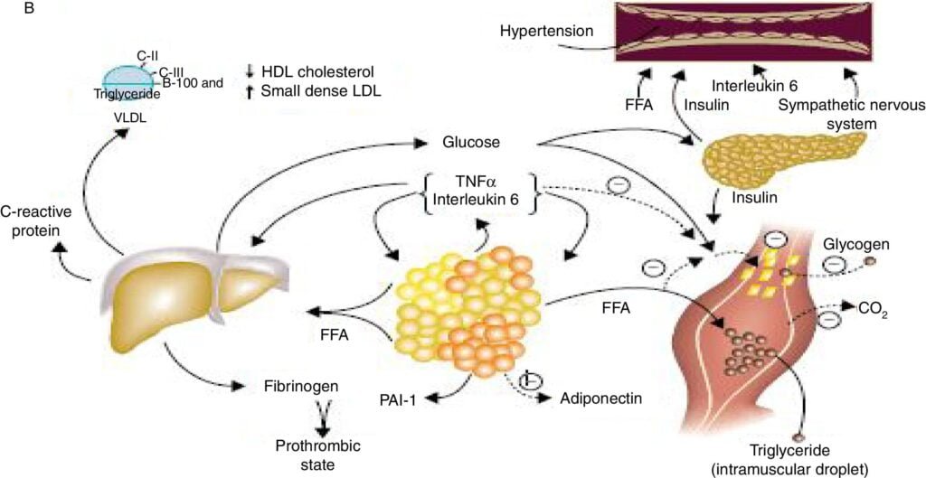 que papel juega la insulina en el sindrome metabolico