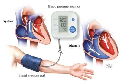 que pruebas se utilizan para el manejo de hipertension