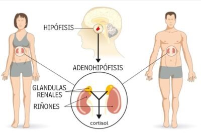 que pruebas se utilizan para el sindrome de cushing