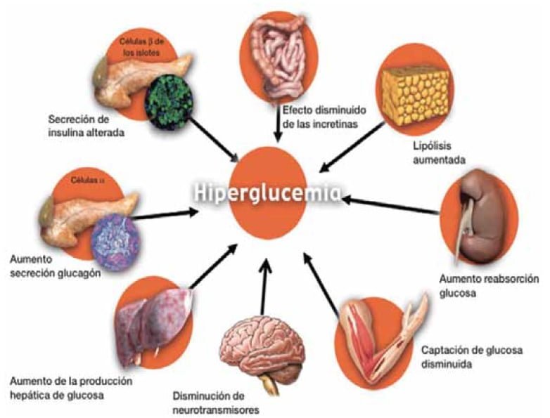 relacion entre hipoglucemia y salud cardiovascular