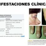 relacion entre la enfermedad de graves y la tirotoxicosis