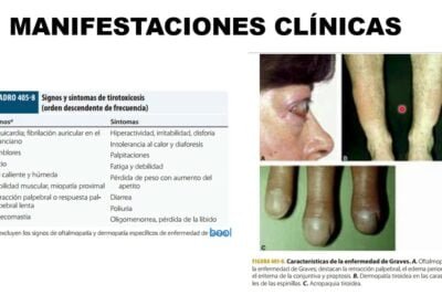 relacion entre la enfermedad de graves y la tirotoxicosis