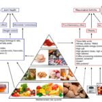 Relación entre obesidad y enfermedades autoinmunes