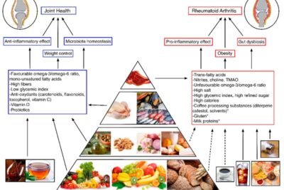 relacion entre obesidad y enfermedades autoinmunes