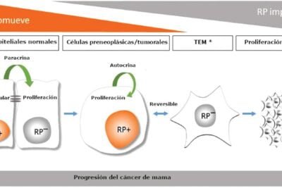 relacion entre progesterona y cancer de mama aspectos clave