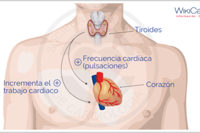 relacion entre tirotoxicosis y enfermedades cardiacas