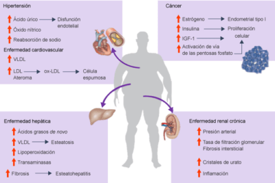 resistencia a la insulina impacto en glandulas y salud metabolica