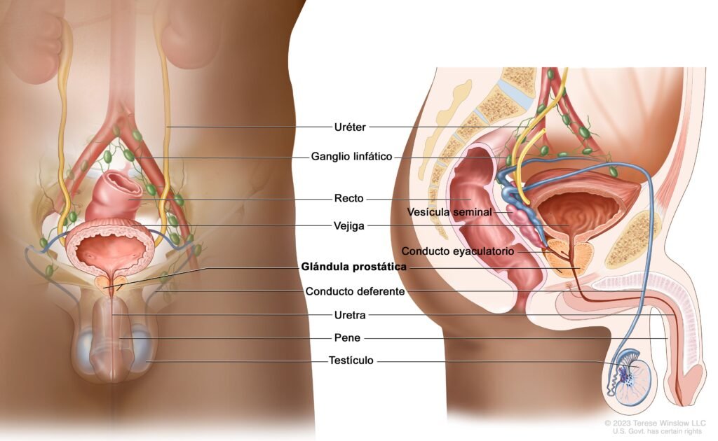 resistencia androgenica en el cancer de prostata que es