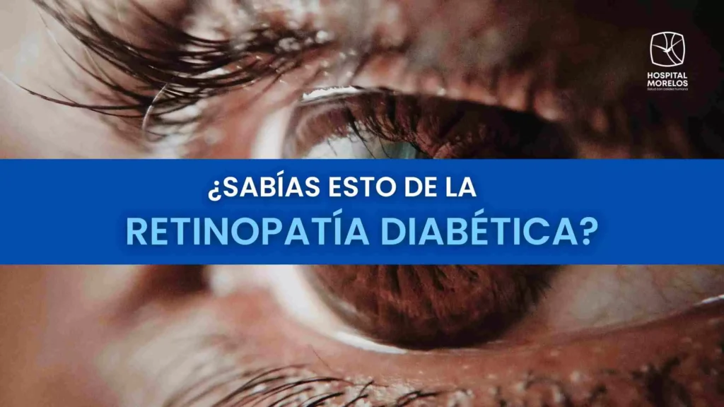 retinopatia diabetica sintomas causas y tratamiento explicado