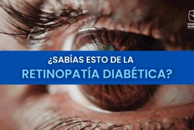 retinopatia diabetica sintomas causas y tratamiento explicado