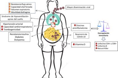riesgos de la obesidad en endocrinologia y su impacto sanitario