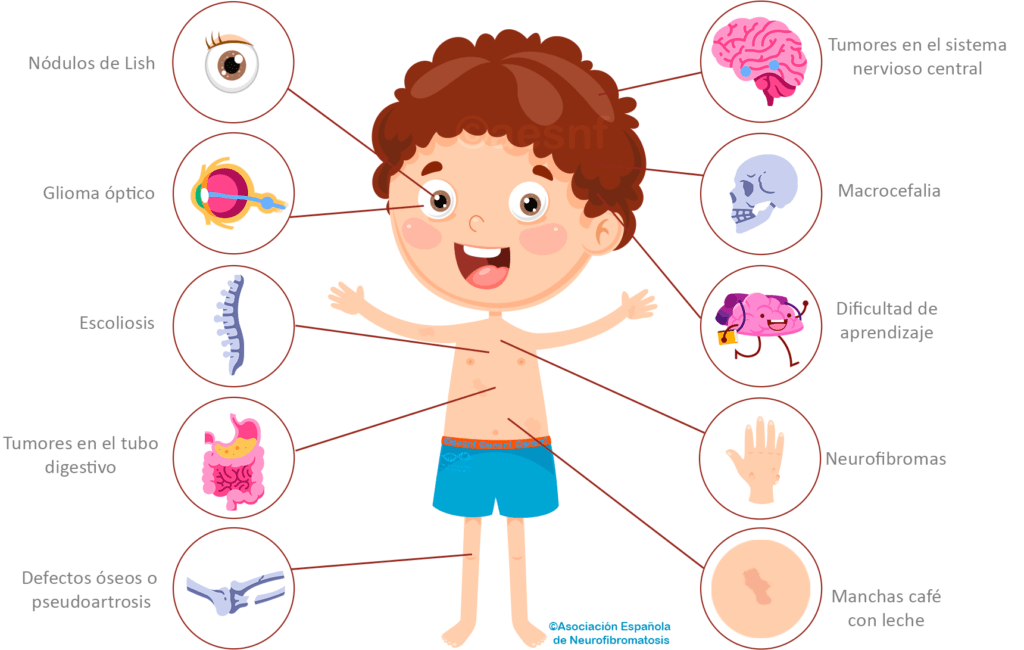 Signos de crecimiento anormal: claves para su identificación 1 signos de crecimiento anormal claves para su identificacion
