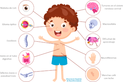 signos de crecimiento anormal claves para su identificacion