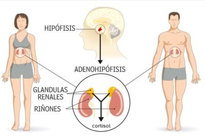 sindrome de cushing causas sintomas y que es esta enfermedad