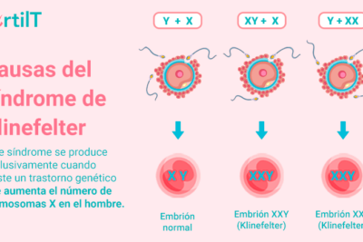 sindrome de klinefelter causas sintomas y tratamientos clave