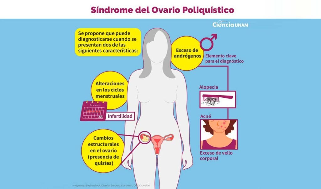 Síndrome de ovario poliquístico: efectos hormonales y síntomas 1 sindrome de ovario poliquistico efectos hormonales y sintomas