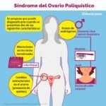 sindrome de ovario poliquistico efectos hormonales y sintomas