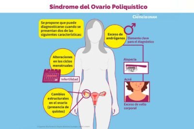 sindrome de ovario poliquistico efectos hormonales y sintomas