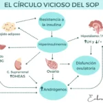 Síndrome de ovario poliquístico y su vínculo con la insulina