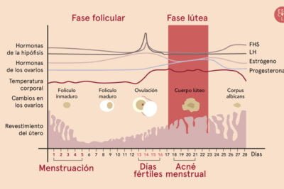 sindrome de ovario poliquistico y su vinculo con la progesterona