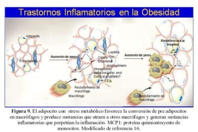 sindrome de resistencia a la insulina que es y su vinculo hormonal