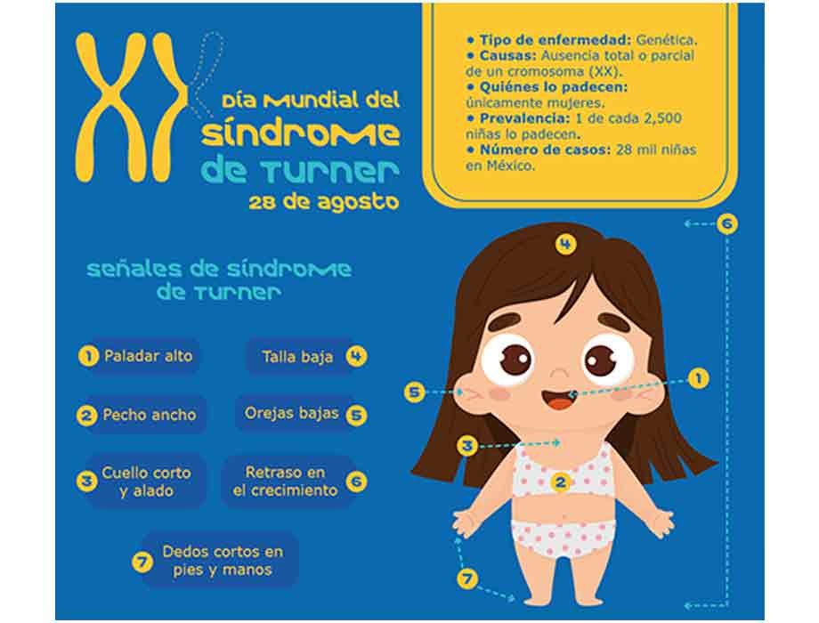 Síndrome de Turner: Impacto en el crecimiento y desarrollo infantil 1 sindrome de turner impacto en el crecimiento y desarrollo infantil