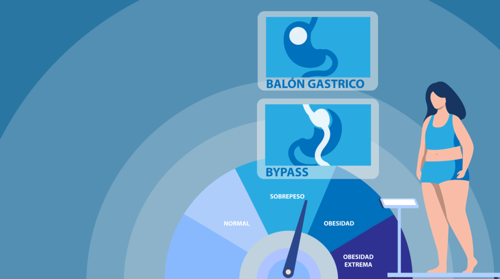 tecnologia innovadora para el manejo eficaz de la obesidad