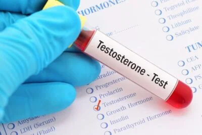 testosterona biodisponible que es y su importancia para la salud