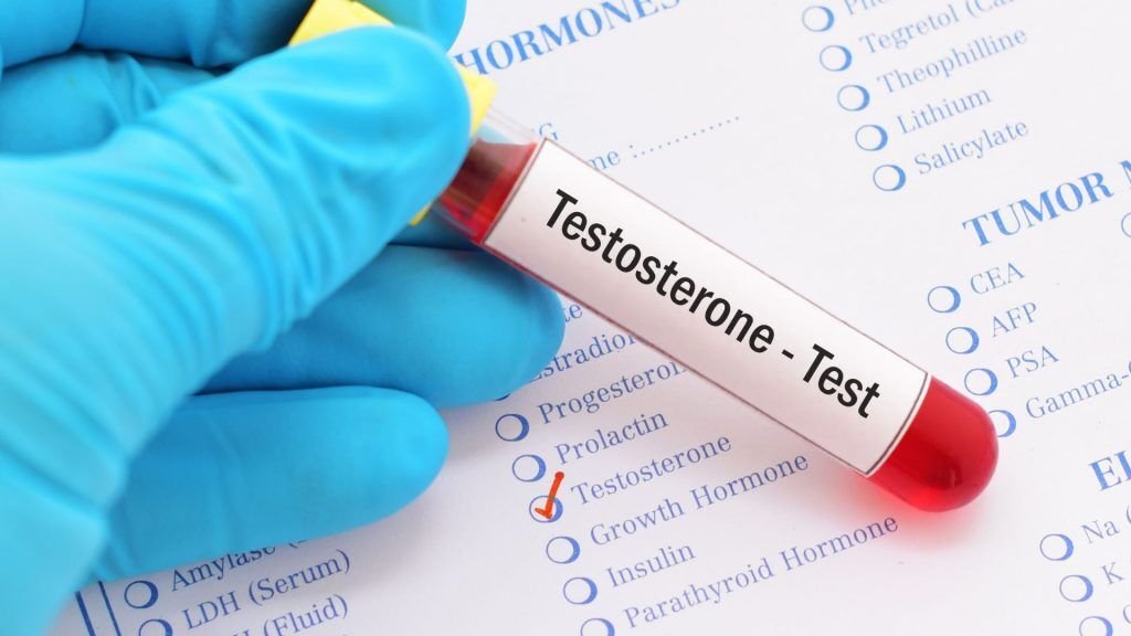 testosterona biodisponible que es y su importancia para la salud