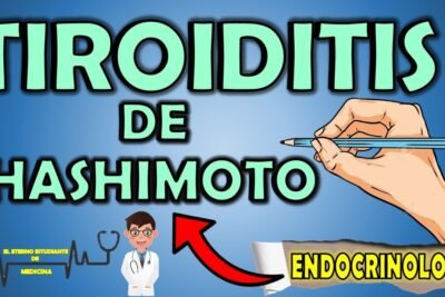 tiroiditis de hashimoto sintomas y tratamiento disponible