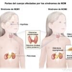 Trastornos del crecimiento y su vínculo con glándulas endocrinas