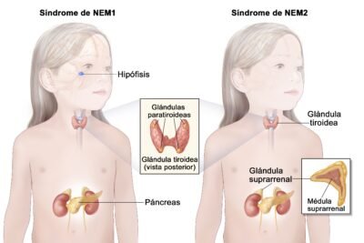 trastornos del crecimiento y su vinculo con glandulas endocrinas