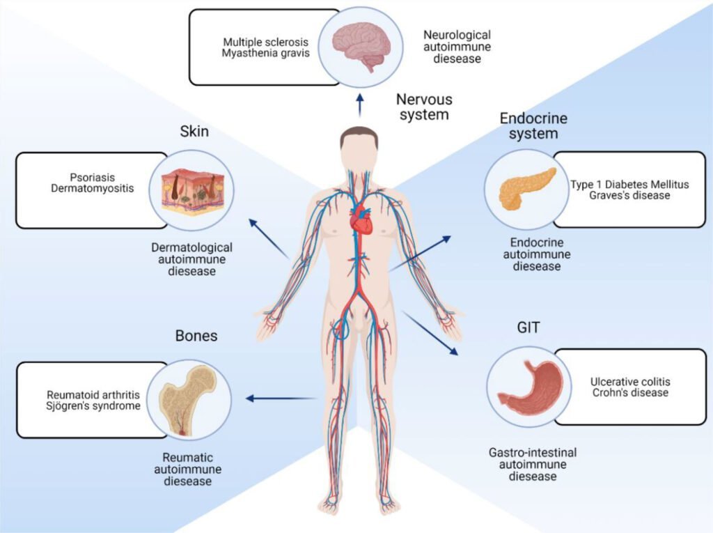 tratamiento de reemplazo hormonal en enfermedades autoinmunes