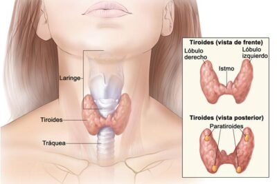 tratamientos efectivos para el hipotiroidismo y sus beneficios