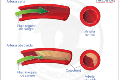 tratamientos para colesterol alto y su relacion con hormonas