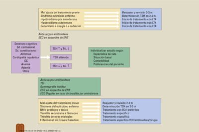 tratamientos para el hipotiroidismo en ancianos opciones clave
