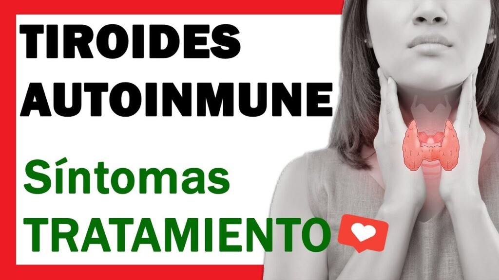 tratamientos para el trastorno autoinmune de la tiroides
