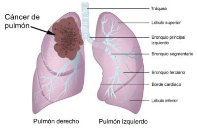 tumores endocrinos caracteristicas clave y definicion esencial